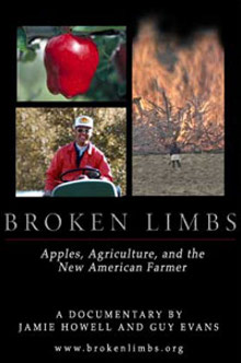 broken limbs